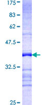 PPP1R15A (Human) Recombinant Protein (Q01)