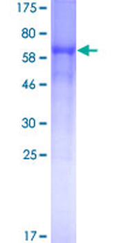 BACE1 (Human) Recombinant Protein (P01)