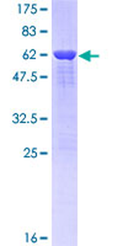 TARDBP (Human) Recombinant Protein (Q01)