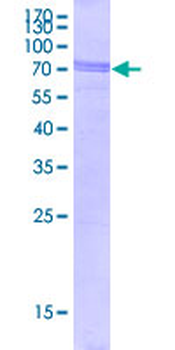 TARDBP (Human) Recombinant Protein (P02)
