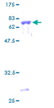 SIRT3 (Human) Recombinant Protein (P01)