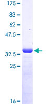 MSRB2 (Human) Recombinant Protein (Q01)
