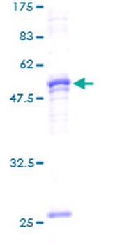 PHB2 (Human) Recombinant Protein (P02)