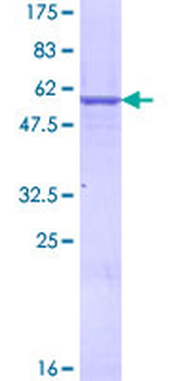 PHB2 (Human) Recombinant Protein (P01)