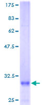 PSIP1 (Human) Recombinant Protein (P01)