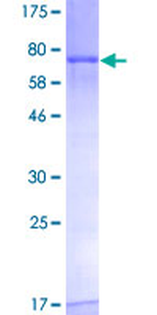 FGFR1OP (Human) Recombinant Protein (P01)