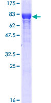 STIP1 (Human) Recombinant Protein (P01)