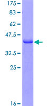FGL2 (Human) Recombinant Protein (Q01)