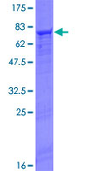 FGL2 (Human) Recombinant Protein (P01)