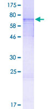 TXNIP (Human) Recombinant Protein (P01)