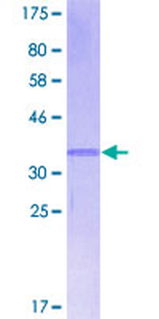 CXCL13 (Human) Recombinant Protein (P01)