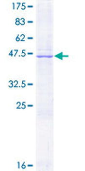 PROCR (Human) Recombinant Protein (P01)