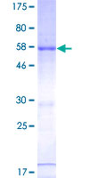 RNASEH2A (Human) Recombinant Protein (P01)