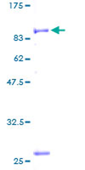 PITRM1 (Human) Recombinant Protein (P01)