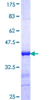 PIBF1 (Human) Recombinant Protein (Q01)