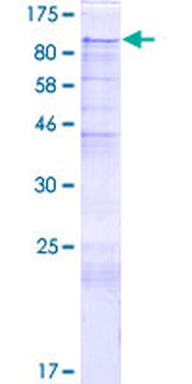 PIBF1 (Human) Recombinant Protein (P01)