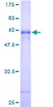 CLEC10A (Human) Recombinant Protein (P01)