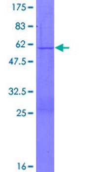 PGRMC2 (Human) Recombinant Protein (P01)