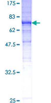 TUBB3 (Human) Recombinant Protein (P01)