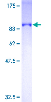 OPTN (Human) Recombinant Protein (P01)
