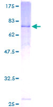 ACTR3 (Human) Recombinant Protein (P01)