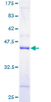 TOMM20 (Human) Recombinant Protein (P01)