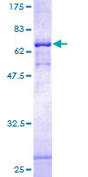 FAM38A (Human) Recombinant Protein (P01)