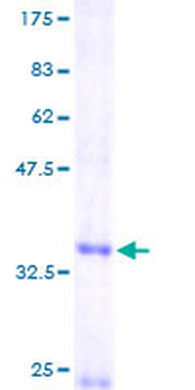 CXCL14 (Human) Recombinant Protein (P01)