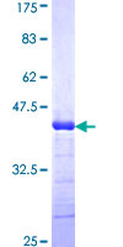 ADAMTS2 (Human) Recombinant Protein (Q01)