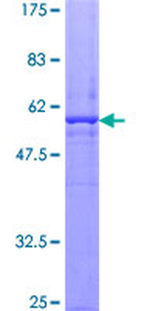 ATG5 (Human) Recombinant Protein (P01)