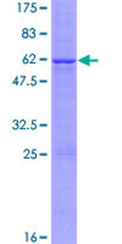 CER1 (Human) Recombinant Protein (P01)