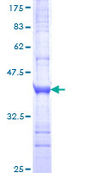 GLP2R (Human) Recombinant Protein (Q01)