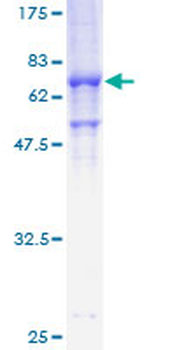 STK17B (Human) Recombinant Protein (P01)