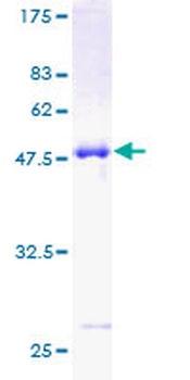 CLIC3 (Human) Recombinant Protein (P01)