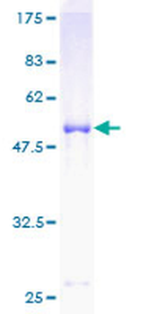 SOCS3 (Human) Recombinant Protein (P01)