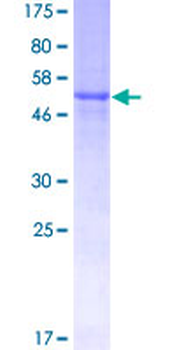 TNFSF10 (Human) Recombinant Protein (P01)