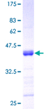 TNFSF13 (Human) Recombinant Protein (P01)