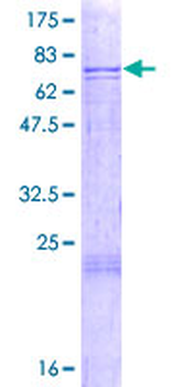 CTSF (Human) Recombinant Protein (P01)