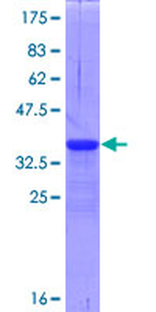 TNFRSF25 (Human) Recombinant Protein (Q01)