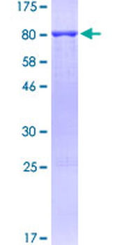 BECN1 (Human) Recombinant Protein (P01)