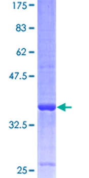 VAMP8 (Human) Recombinant Protein (P01)