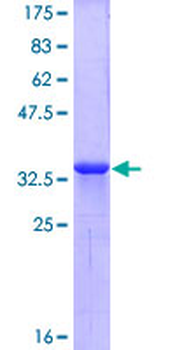 CXCR4 (Human) Recombinant Protein (Q01)