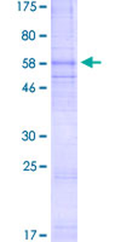CXCR4 (Human) Recombinant Protein (P01)