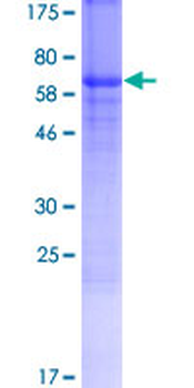 ZP3 (Human) Recombinant Protein (P01)