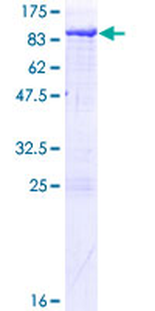 XPNPEP1 (Human) Recombinant Protein (P01)