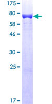 VIM (Human) Recombinant Protein (P01)