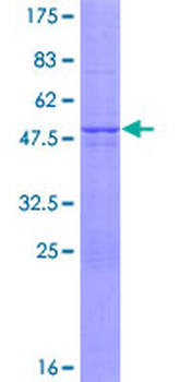 VHL (Human) Recombinant Protein (P01)