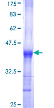UGDH (Human) Recombinant Protein (Q01)
