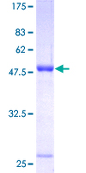UCHL1 (Human) Recombinant Protein (P01)