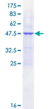 UBE2E1 (Human) Recombinant Protein (P01)